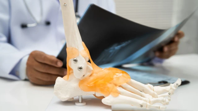 Dây chằng nhân tạo: Những điều bạn cần hiểu rõ