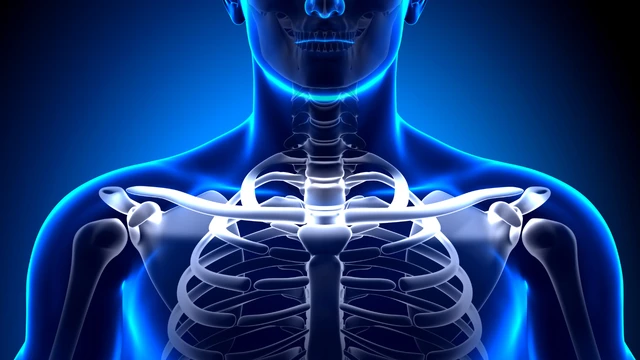 Tư thế nằm ngủ khi bị gãy xương đòn giúp giảm đau và sớm phục hồi 