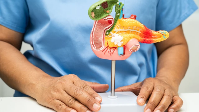 Điều trị polyp túi mật​ cách nào hiệu quả?