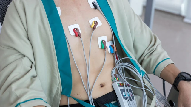 Đo điện tim là gì? Đối tượng, quy trình và phân loại