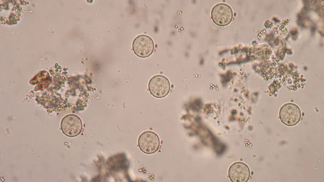 E. histolytica là gì? Nguyên nhân, triệu chứng và cách phòng ngừa hiệu quả