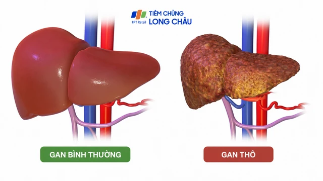 Gan thô nhẹ có phục hồi được không?