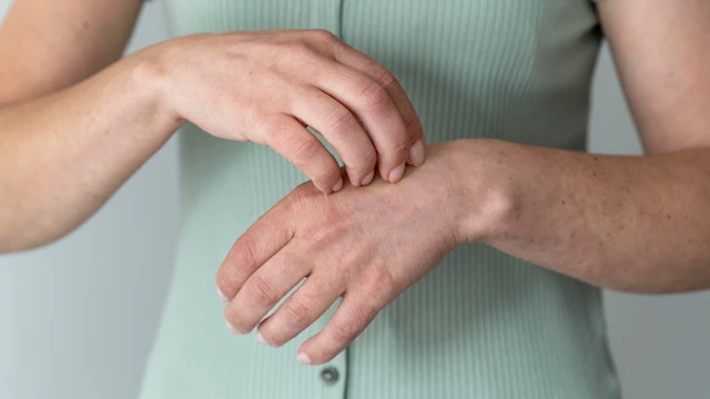Ghẻ nước ở tay: Nguyên nhân, dấu hiệu và cách xử lý hiệu quả