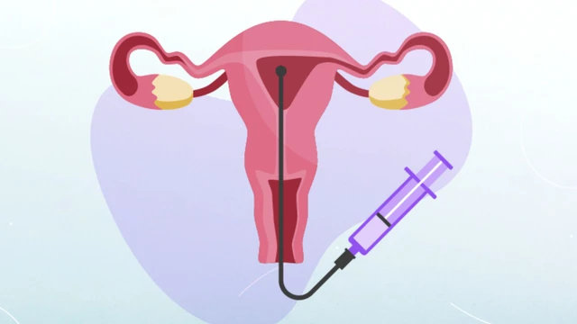 Vòi trứng thông hạn chế có làm IUI được không? Khi nào nên chuyển sang IVF?