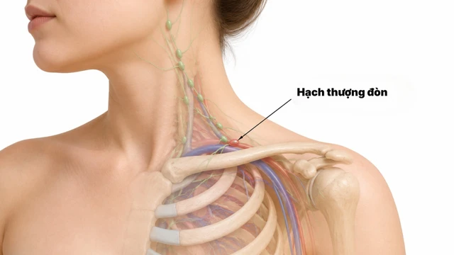 Hạch thượng đòn nằm ở đâu? Khi nào cần đến gặp bác sĩ?