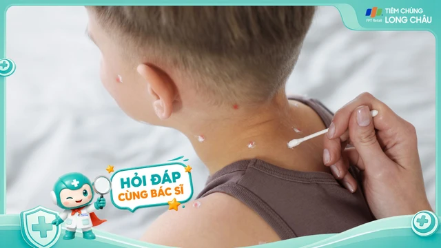 Người lớn bị thủy đậu có nguy hiểm hơn trẻ em không?