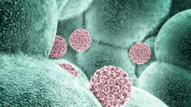 HPV 35 có thể gây ra những bệnh lý nào? Có thể phòng ngừa được không?