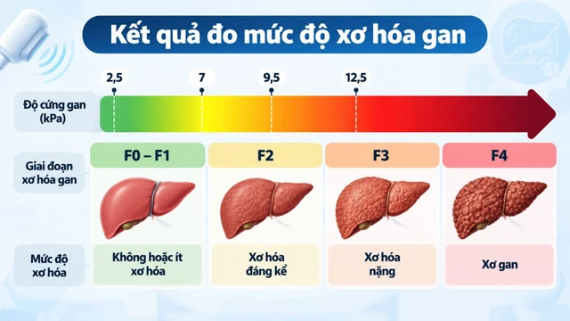 ket_qua_do_muc_do_xo_hoa_gan_co_y_nghia_gi_1_c645547a94