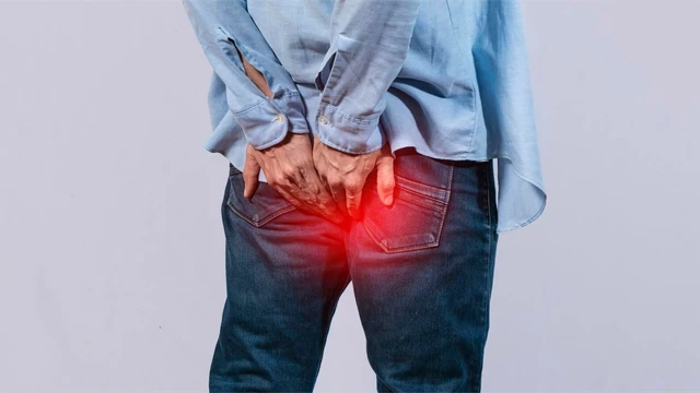 Loạn sản hậu môn là gì? Triệu chứng, nguyên nhân, chẩn đoán và điều trị