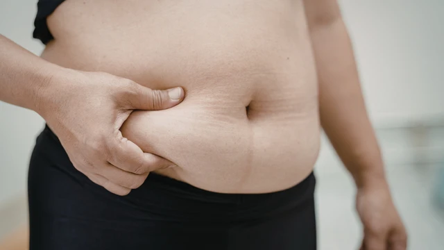 Mỡ bụng: Nguyên nhân hình thành và cách giảm hiệu quả