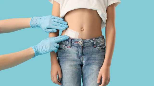Mổ ruột thừa bao lâu thì làm việc nặng được?