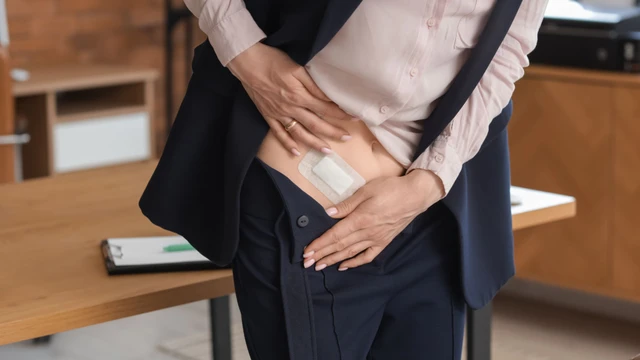 Mổ ruột thừa và những điều người bệnh cần biết