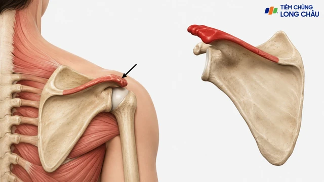 Mỏm gai xương bả vai: Cấu trúc, chức năng và bệnh lý thường gặp
