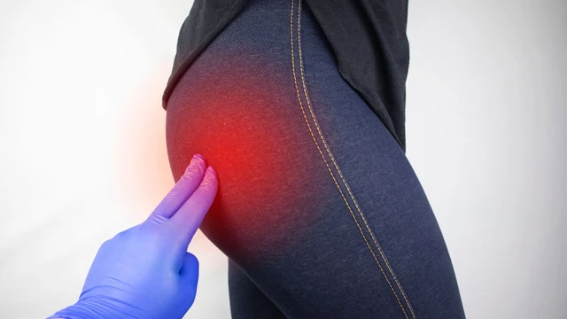 Mụn nhọt ở mông sưng to đau nhức là do đâu và cách phòng ngừa?