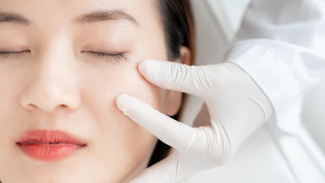 Nâng gò má là gì? Tác dụng và những điều cần biết