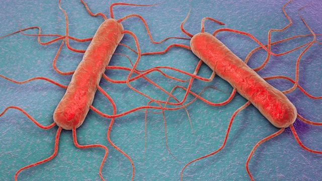 Ngộ độc Listeria là gì? Triệu chứng, nguyên nhân và cách phòng ngừa