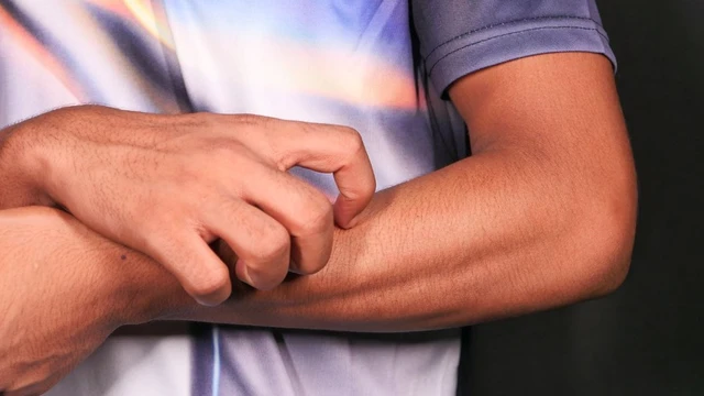 Ngứa toàn thân là bệnh gì? Cảm giác ngứa toàn thân do nguyên nhân nào gây ra?