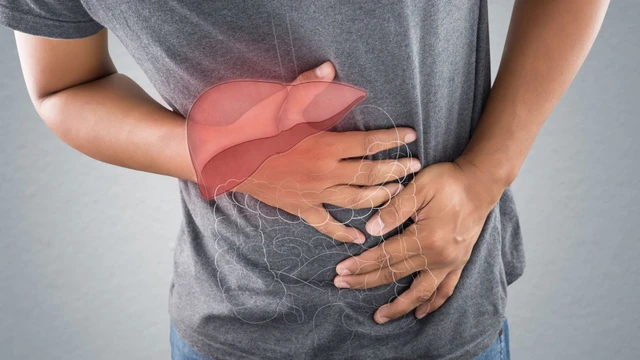 Người bị bệnh viêm gan A thường có triệu chứng gì và cách phòng bệnh