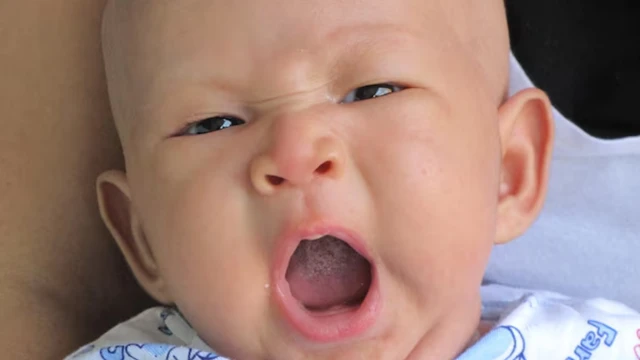 Nguyên nhân và cách xử lý vòm miệng trẻ sơ sinh bị trắng
