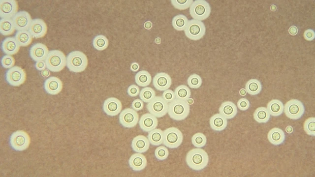 Nhiễm nấm Cryptococcus: Triệu chứng, mức độ nguy hiểm và cách điều trị
