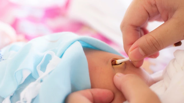 Nhiễm trùng rốn ở trẻ sơ sinh là gì? Cách chăm sóc rốn an toàn cho trẻ