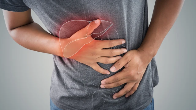 Những triệu chứng xơ gan cổ trướng và cách phòng ngừa