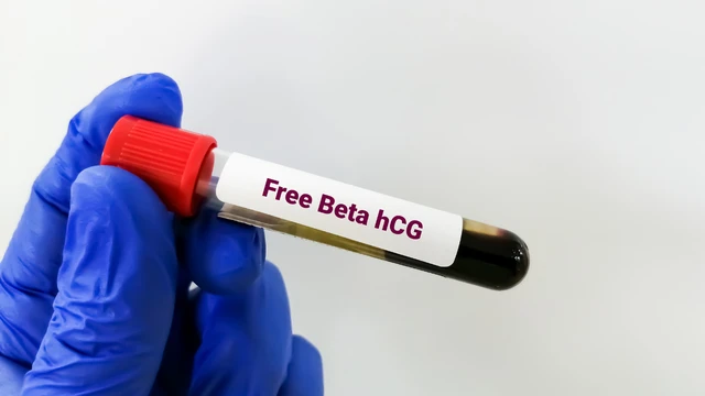 Nồng độ beta HCG là gì và cách đọc kết quả xét nghiệm thai kỳ chính xác?