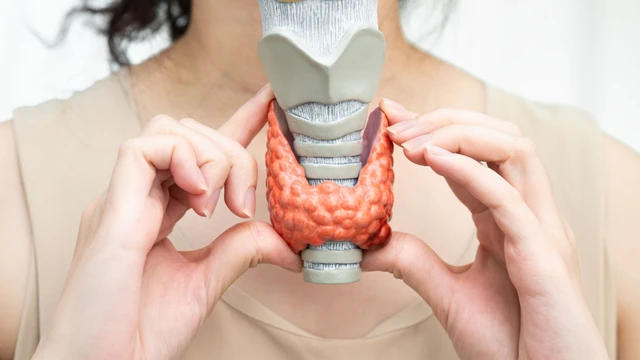 Phình giáp là gì? Nguyên nhân, triệu chứng và hướng điều trị an toàn