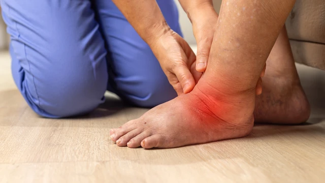Phù nề sau chấn thương bao lâu thì hết? Cách xử lý an toàn