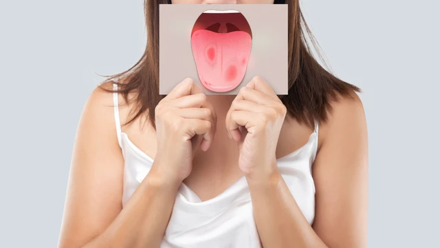 Rách lưỡi có tự lành không? Nguyên nhân thường gặp và cách xử lý an toàn