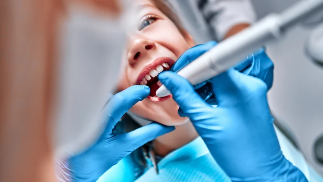 Răng trám rồi có trám lại được không và những điều cần biết?