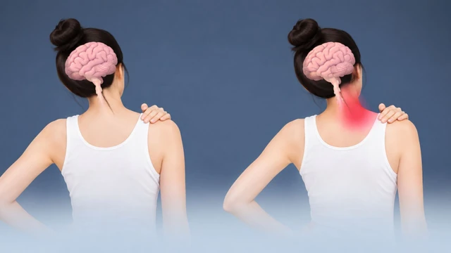 Rối loạn trương lực cơ là bệnh gì? Nguyên nhân, triệu chứng và cách điều trị