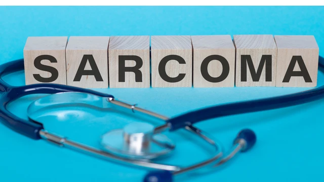 Sarcoma cơ vân: Dấu hiệu nhận biết sớm, nguyên nhân và hướng điều trị