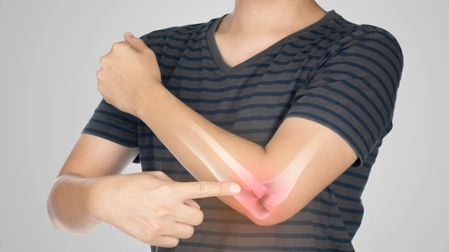 Sarcoma Ewing: Nhận biết sớm dấu hiệu cảnh báo để nâng cao hiệu quả điều trị