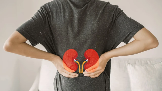 Sỏi niệu quản 1/3 dưới là gì? Triệu chứng và cách điều trị