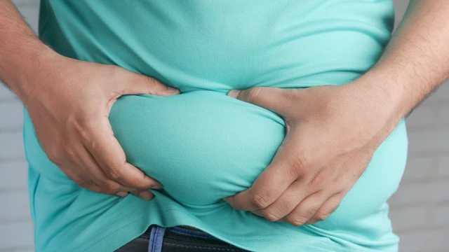 Sốt xuất huyết nặng hơn ở người thừa cân béo phì và cách phòng ngừa
