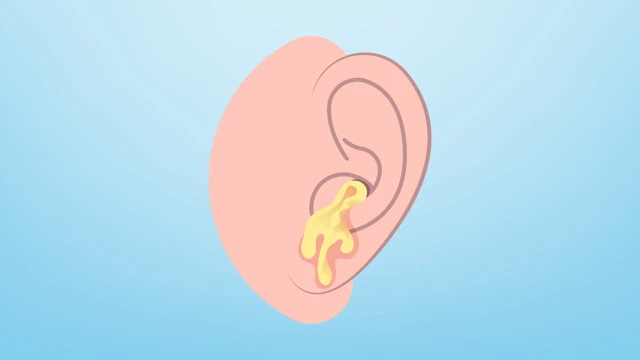 Phương pháp điều trị tình trạng tai chảy dịch vàng​ an toàn hiệu quả