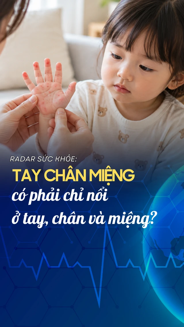 tay_chan_mieng_co_phai_chi_noi_o_tay_chan_va_mieng_64080cdf19
