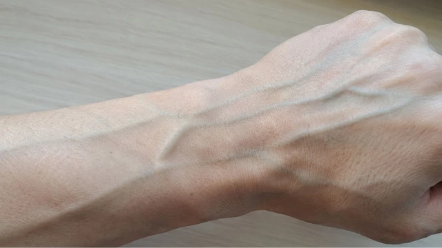Tay nổi gân xanh do đâu? Vị trí thường xuất hiện gân xanh