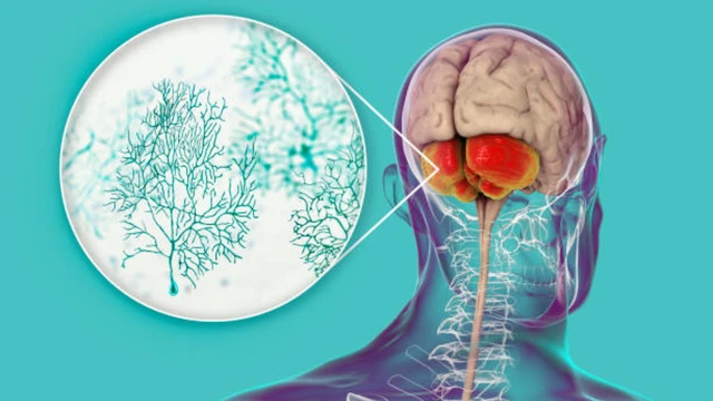 Tế bào Purkinje: Cấu trúc, chức năng và vai trò trong não bộ