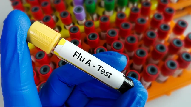 Test cúm A vào thời điểm nào và có những phương pháp xét nghiệm nào?