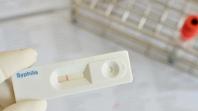 Test nhanh giang mai là gì? Quy trình, ưu điểm và độ chính xác thực tế
