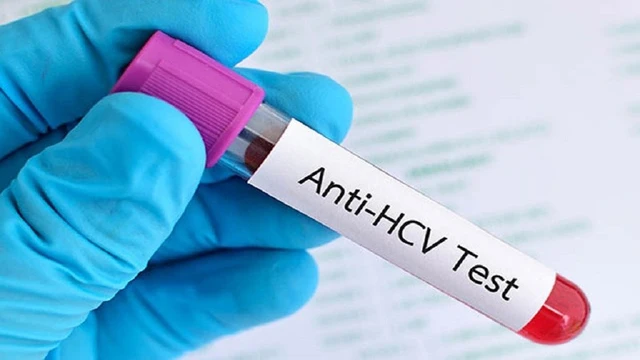 Test nhanh viêm gan C: Có chính xác không và ai nên thực hiện?