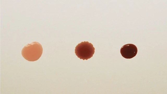 Thai IVF bị ra dịch nâu: Mức độ nguy hiểm, nguyên nhân và cách xử lý an toàn