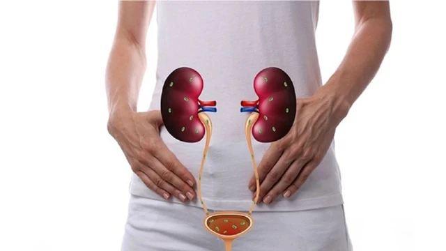 Thận ứ nước độ 1: Nguyên nhân, triệu chứng, chẩn đoán và cách điều trị