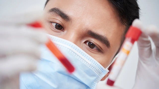 Thiếu máu hồng cầu nhỏ: Nguyên nhân, dấu hiệu và cách điều trị