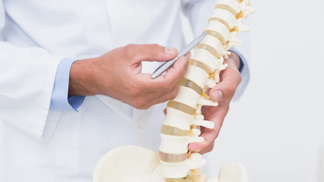 Thoái hóa cột sống là gì? Nguyên nhân, triệu chứng và điều trị