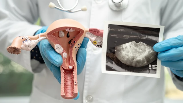 Thực đơn cho người bị đa nang buồng trứng: Nên và không nên ăn gì?