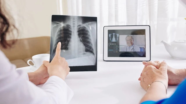 Thuốc điều trị lao phổi: Những điều người bệnh cần biết để dùng đúng và an toàn