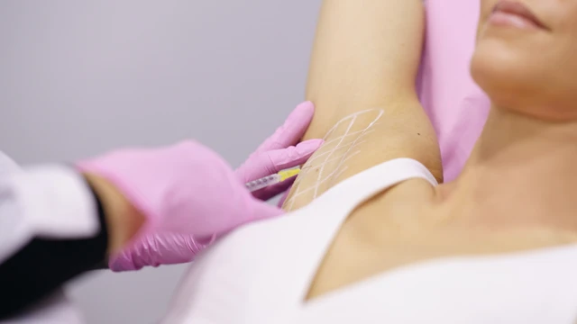 Tiêm Botox trị hôi nách được bao lâu và cách duy trì hiệu quả